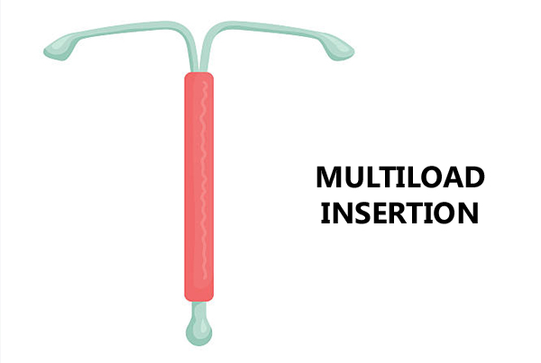 Multiload Insertion
